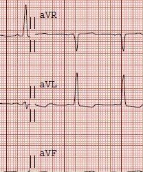 Imagen 26 Abba Burgos Hotel foto