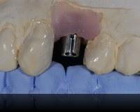 Imagen 10 Casa de Artes y Circo Contemporáneo foto