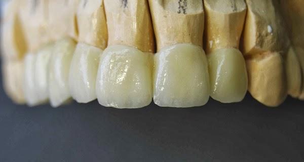 Imagen 14 BOSPRODEN, Bosch Protesis Dental foto