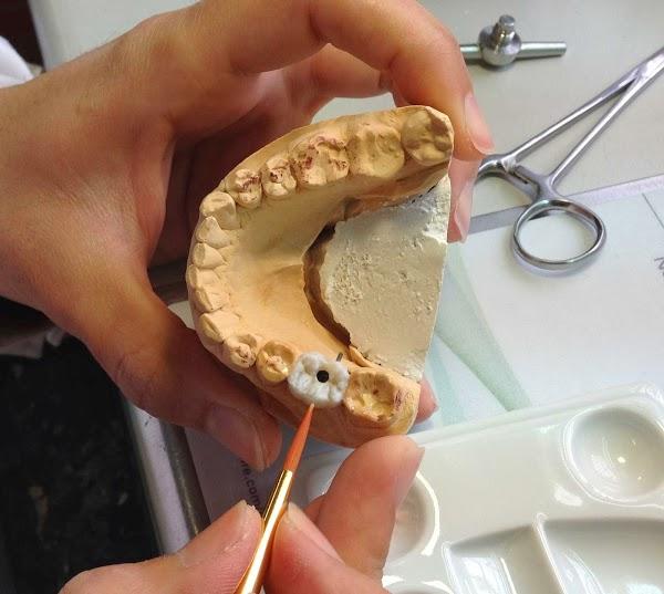 Imagen 23 BOSPRODEN, Bosch Protesis Dental foto