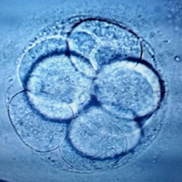 Imagen 68 Norestim, Cerrajería y Carpintería Metálica foto