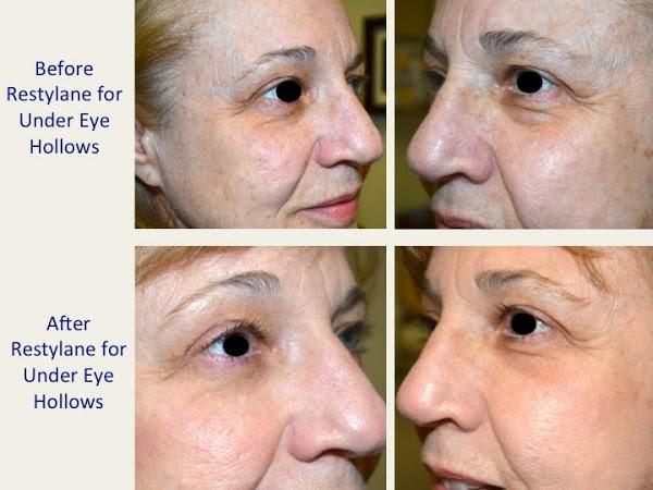 Imagen 8 Tecnica S.A. Peugeot foto