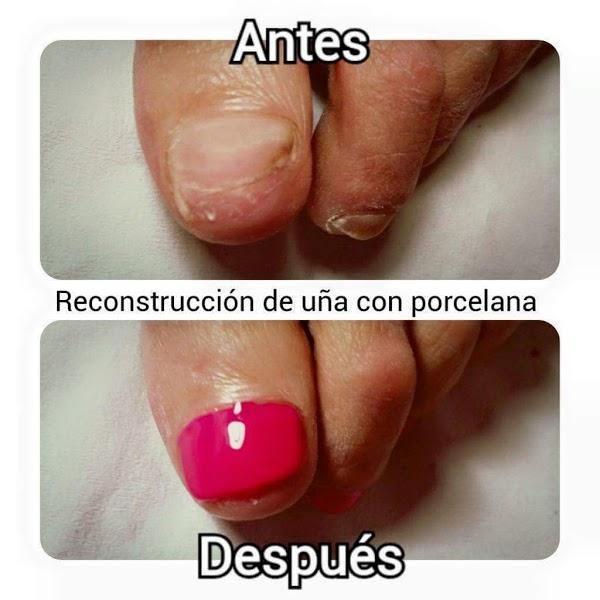 Imagen 79 Centro de Estetica Y Terapias Lilium foto