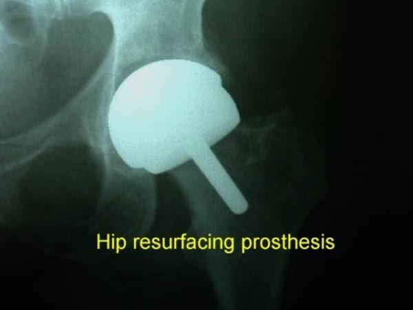 Imagen 16 Centro de Estética Antonia Gala foto