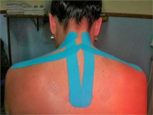 Imagen 81 FISIOTERAPIA Y ESTETICA STELLA MARIS foto