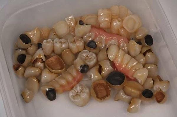 Imagen 12 BLUERAYSERVEIS foto