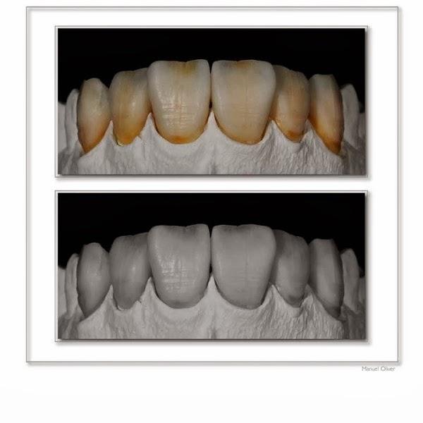 Imagen 14 BLUERAYSERVEIS foto