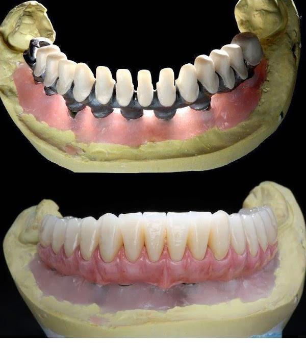 Imagen 21 BLUERAYSERVEIS foto