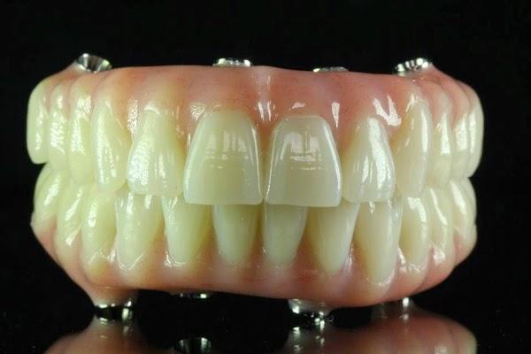 Imagen 23 BLUERAYSERVEIS foto