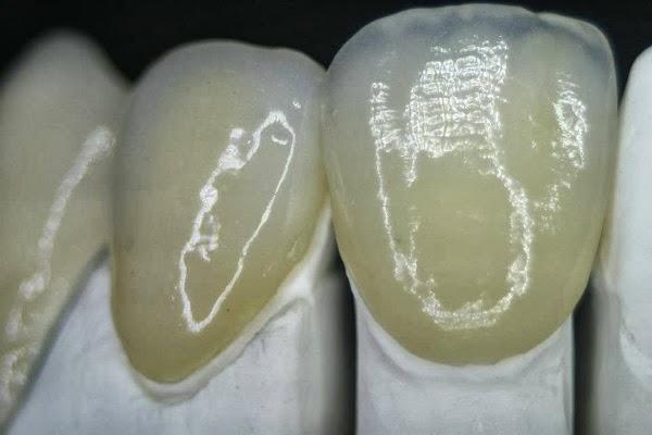 Imagen 29 BLUERAYSERVEIS foto