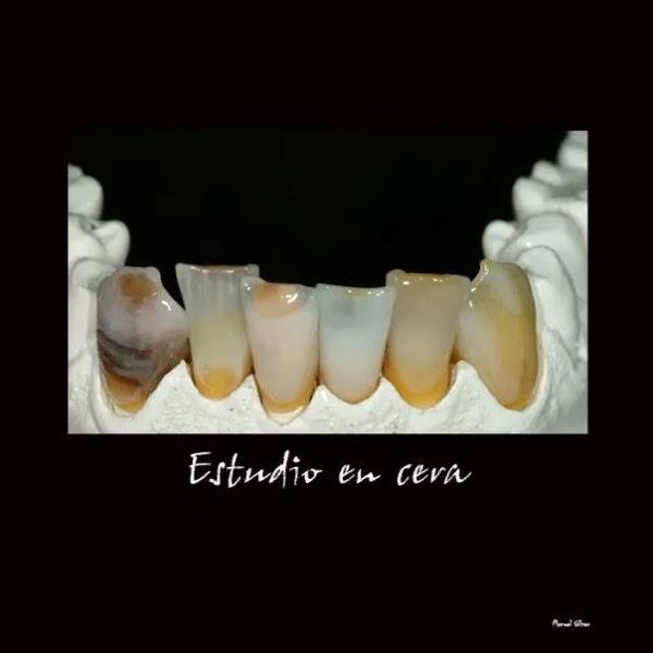 Imagen 30 BLUERAYSERVEIS foto