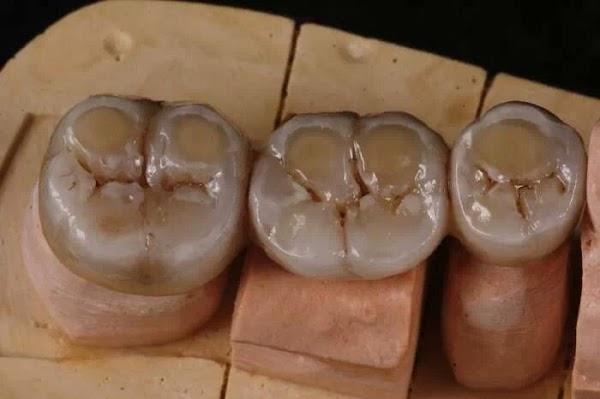 Imagen 34 BLUERAYSERVEIS foto