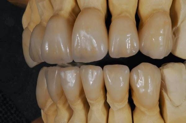 Imagen 39 BLUERAYSERVEIS foto